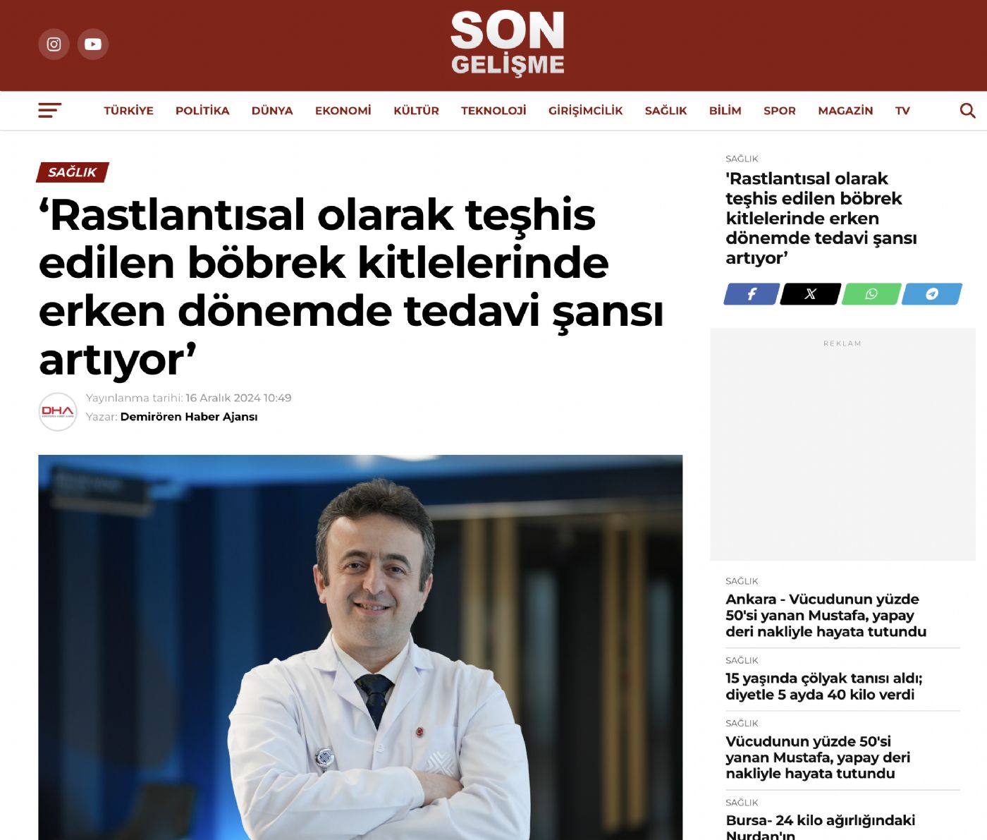 ‘Rastlantısal olarak teşhis edilen böbrek kitlelerinde erken dönemde tedavi şansı artıyor’ - Son Gelişme