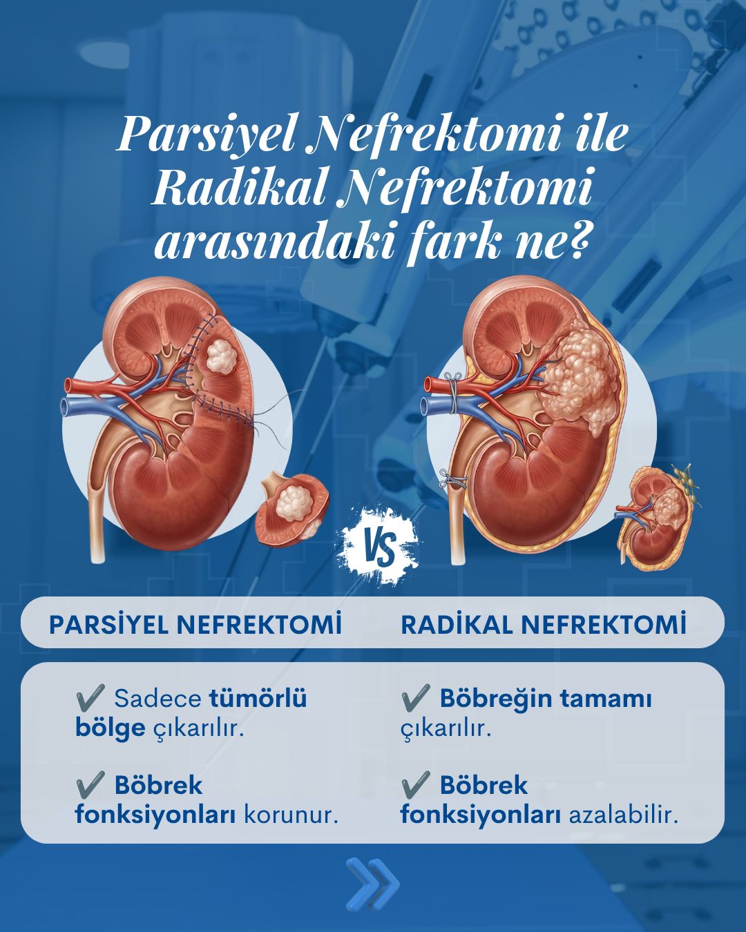 Parsiyel Nefrektomi ve Radikal Nefrektomi Arasındaki Fark Nedir?